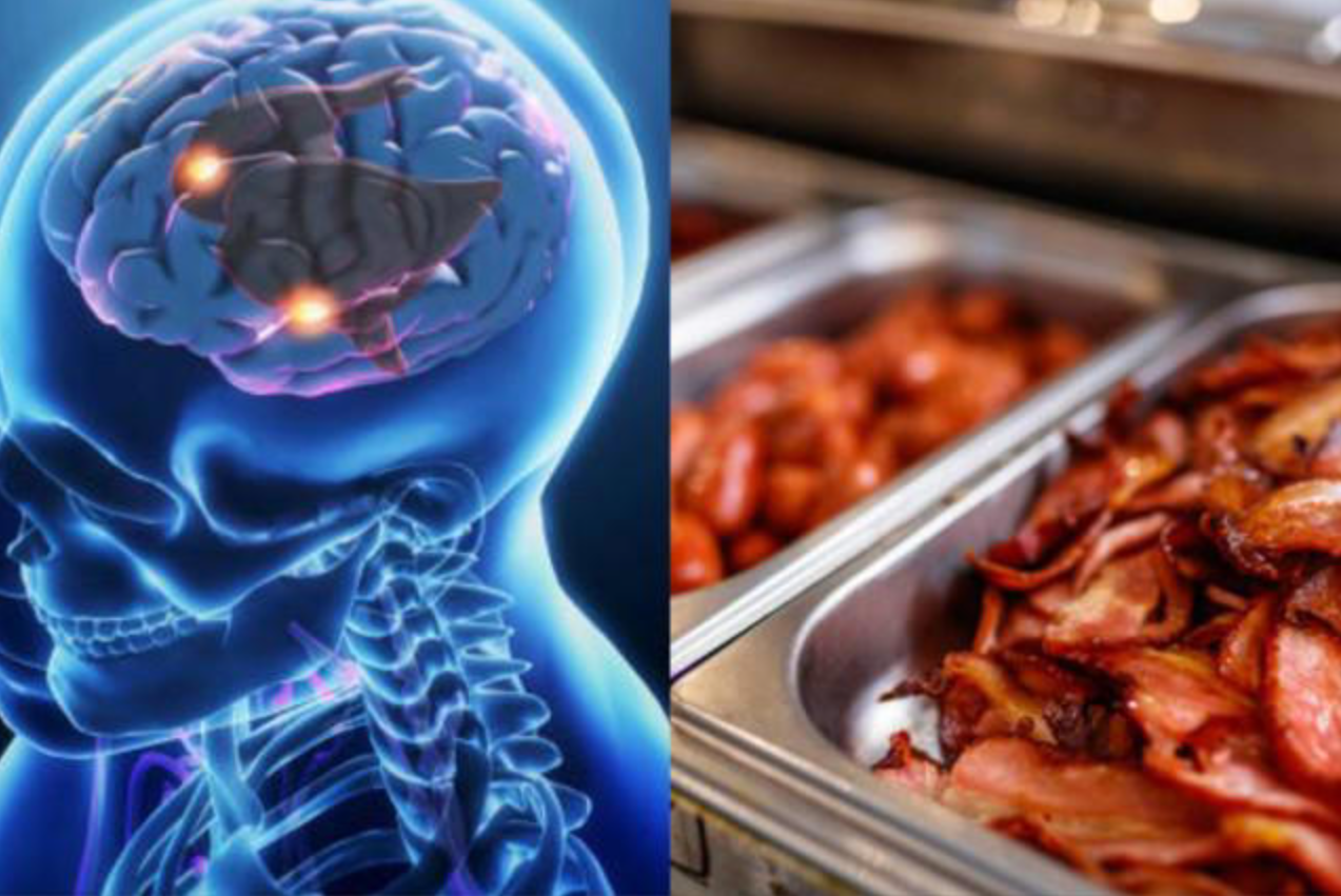 Los alimentos que dañan la memoria: lo que debe evitar para proteger su cerebro